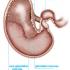 Equine Gastric Ulcer Syndrome (EGUS)